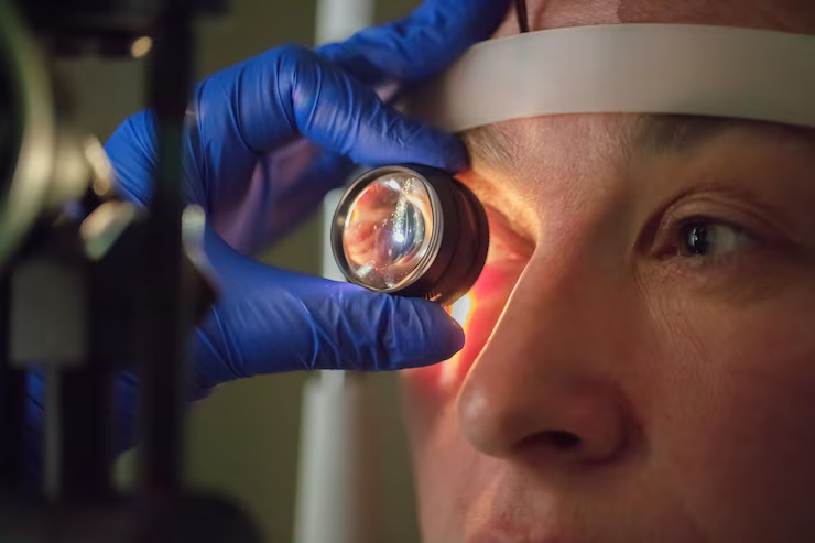 The Benefits Of Cataract Surgery: What You Need To Know