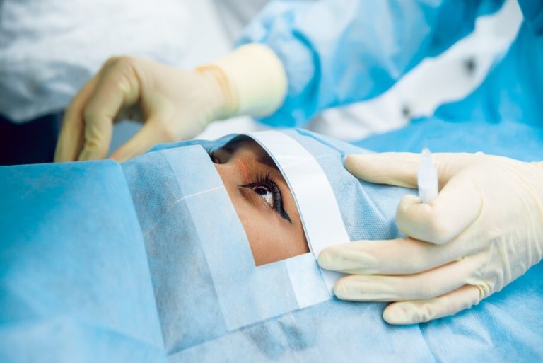 Choosing The Right Surgeon For Your Previous Eye Surgery