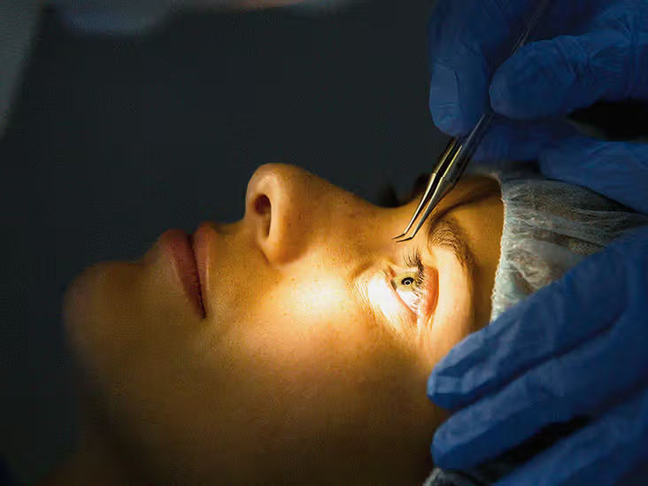 Previous Eye Surgery in Sushant Lok Phase 1